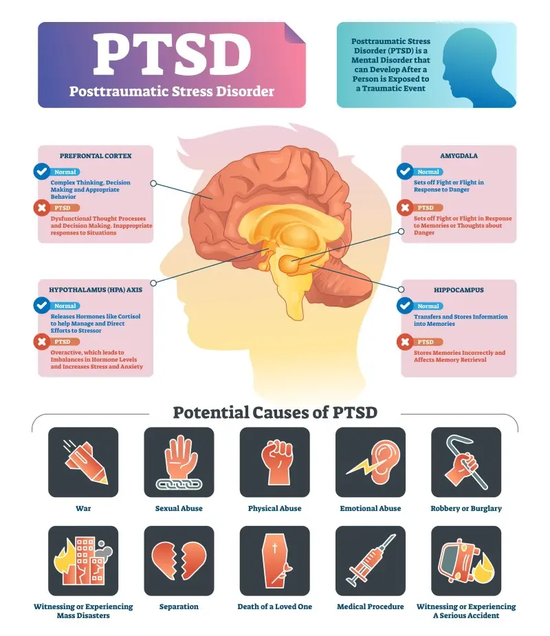 Treating PTSD with Ketamine Infusions