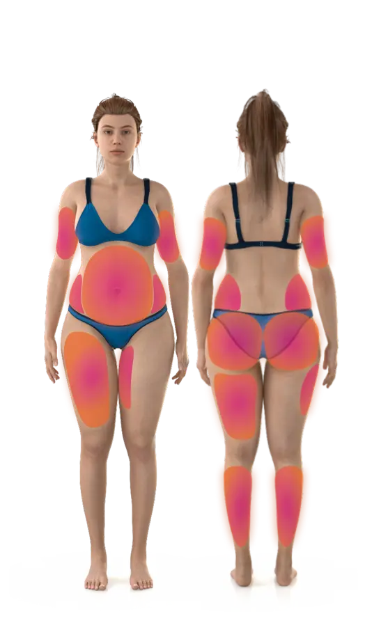 Woman showing Emsculpt NEO treatment areas