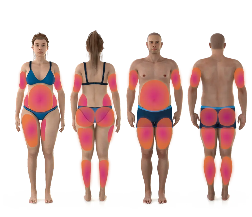 Emsculpt NEO treatment areas for women and men