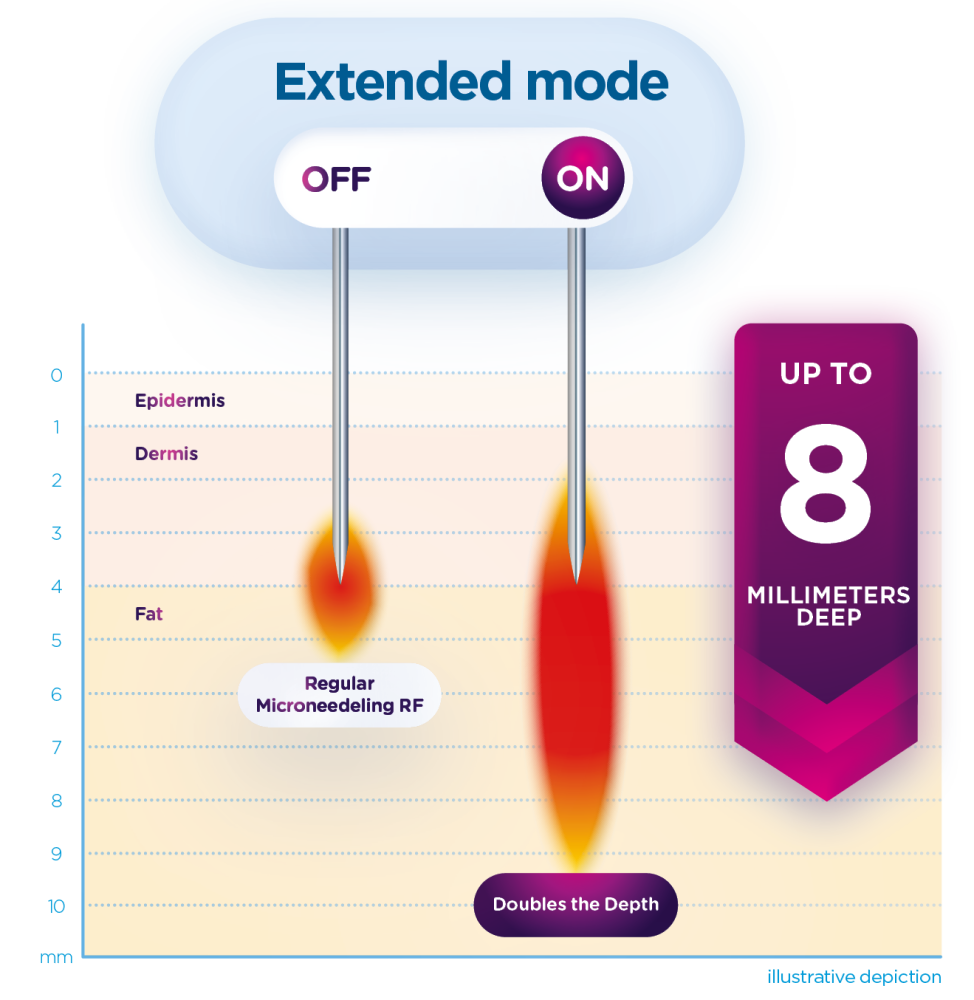 EXION Fractional RF mechanism of action graphic for RF microneedling